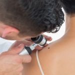 male dermatologist examining mole on back of woman in clinic